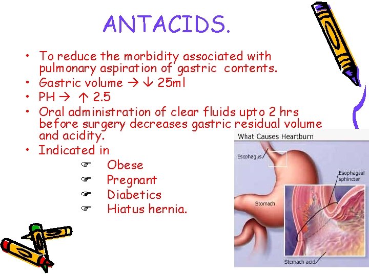 ANTACIDS. • To reduce the morbidity associated with pulmonary aspiration of gastric contents. •
