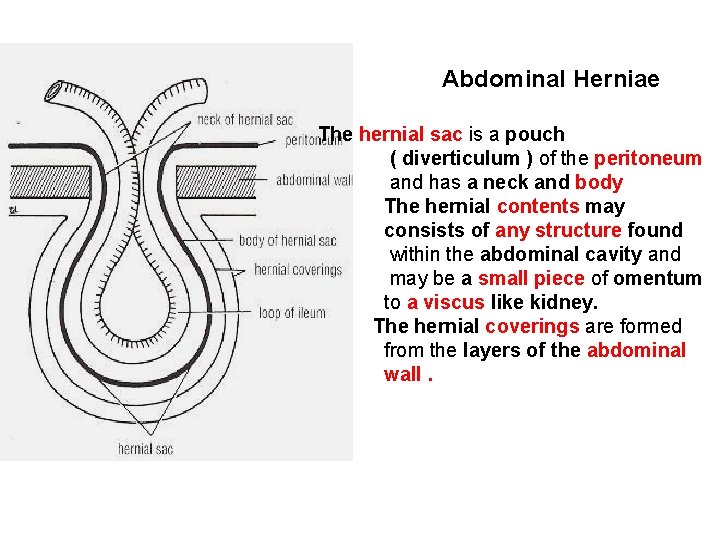 Abdominal Herniae The hernial sac is a pouch ( diverticulum ) of the peritoneum