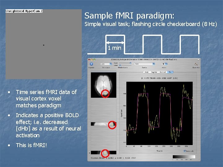 Sample f. MRI paradigm: Simple visual task; flashing circle checkerboard (8 Hz) 1 min