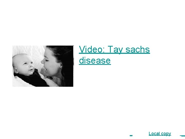 Video: Tay sachs disease _ source Local copy _ 