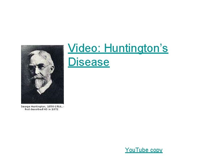Video: Huntington’s Disease You. Tube copy 
