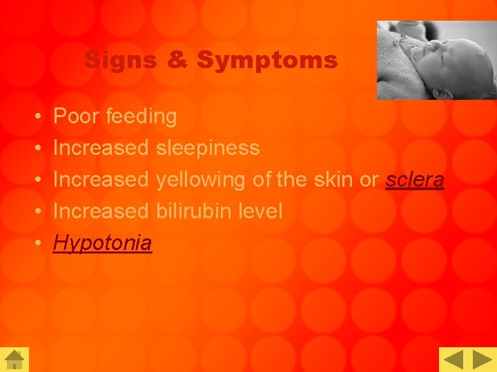 Signs & Symptoms • • • Poor feeding Increased sleepiness Increased yellowing of the