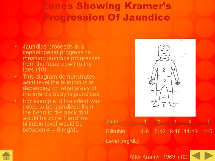 Zones Showing Kramer’s Progression Of Jaundice • Jaundice proceeds in a cephalopedal progression, meaning