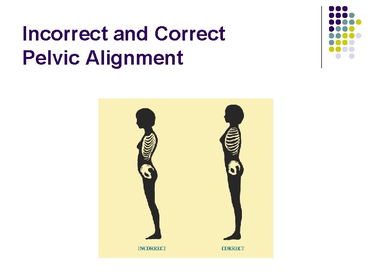 Incorrect and Correct Pelvic Alignment 