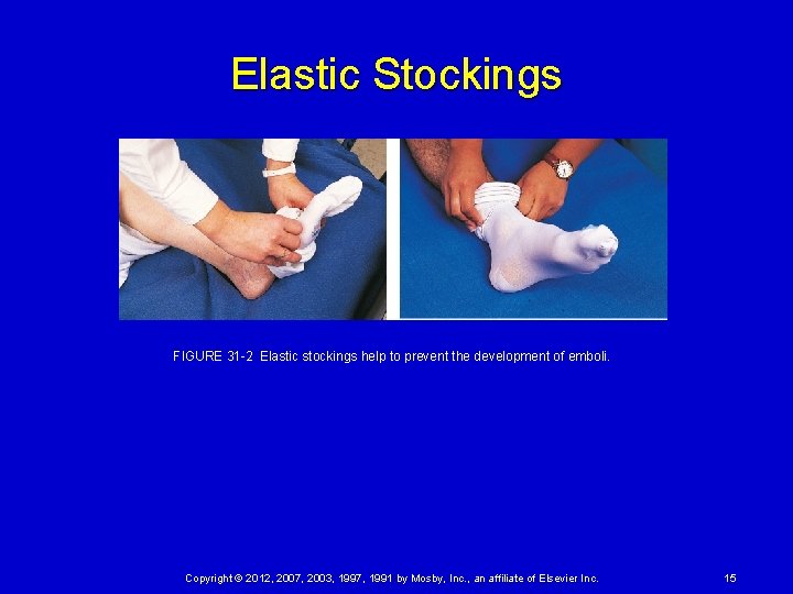 Elastic Stockings FIGURE 31 -2 Elastic stockings help to prevent the development of emboli. Copyright
