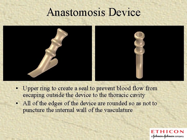 Anastomosis Device • Upper ring to create a seal to prevent blood flow from
