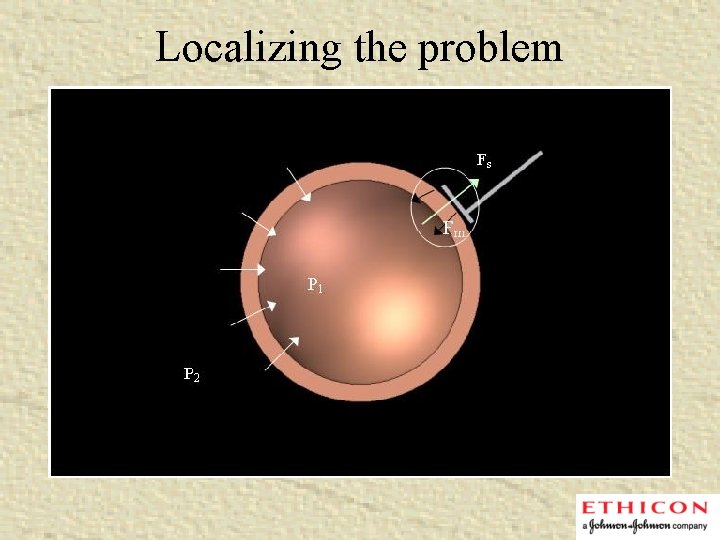 Localizing the problem 