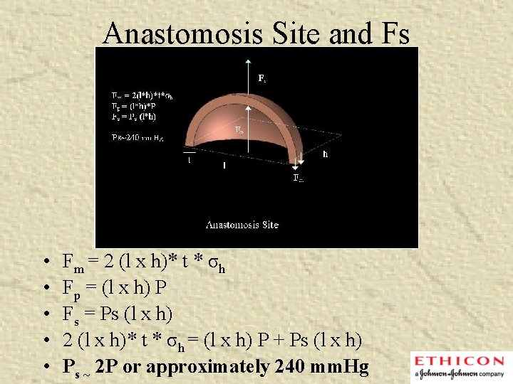 Anastomosis Site and Fs • • • Fm = 2 (l x h)* t
