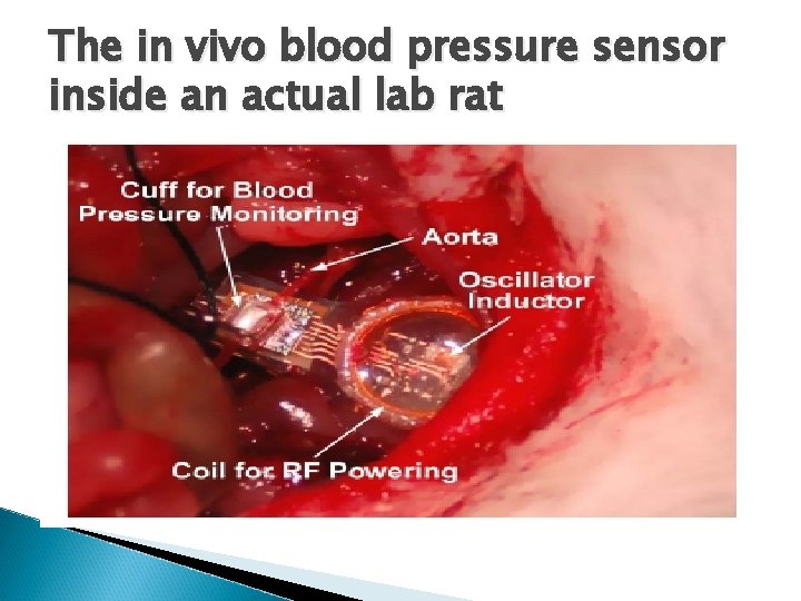 The in vivo blood pressure sensor inside an actual lab rat 