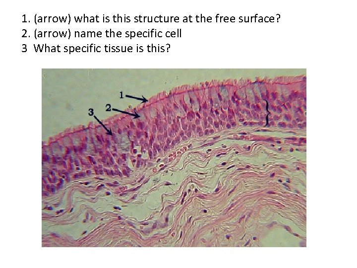 1. (arrow) what is this structure at the free surface? 2. (arrow) name the