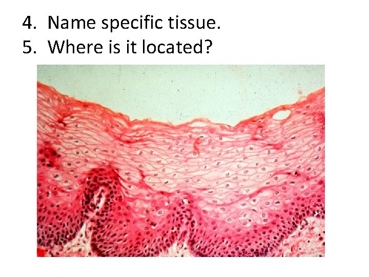 4. Name specific tissue. 5. Where is it located? 