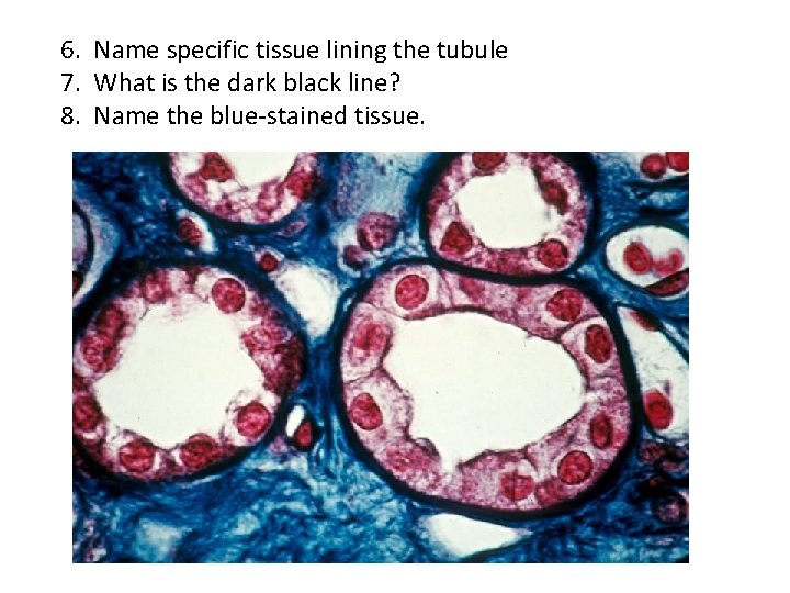 6. Name specific tissue lining the tubule 7. What is the dark black line?