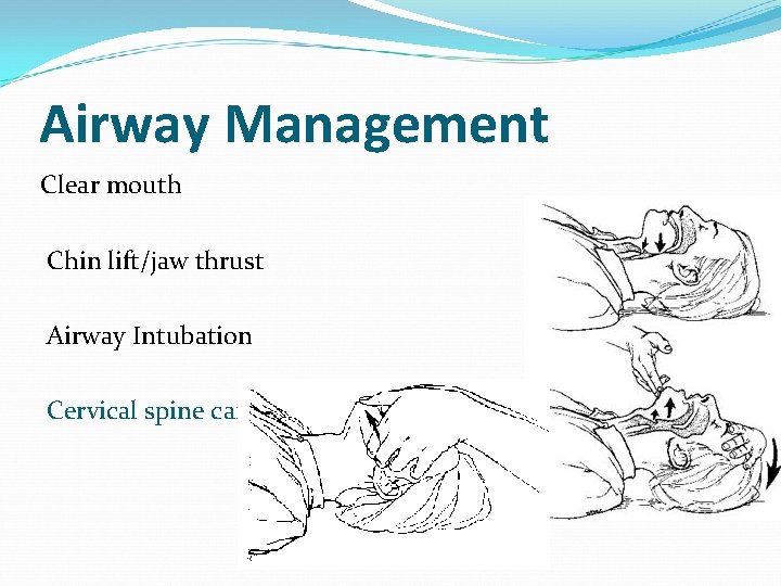 Airway Management Clear mouth Chin lift/jaw thrust Airway Intubation Cervical spine care 