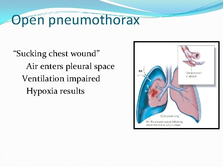 Open pneumothorax “Sucking chest wound” Air enters pleural space Ventilation impaired Hypoxia results 