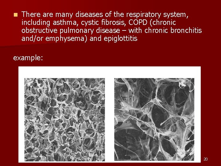 n There are many diseases of the respiratory system, including asthma, cystic fibrosis, COPD