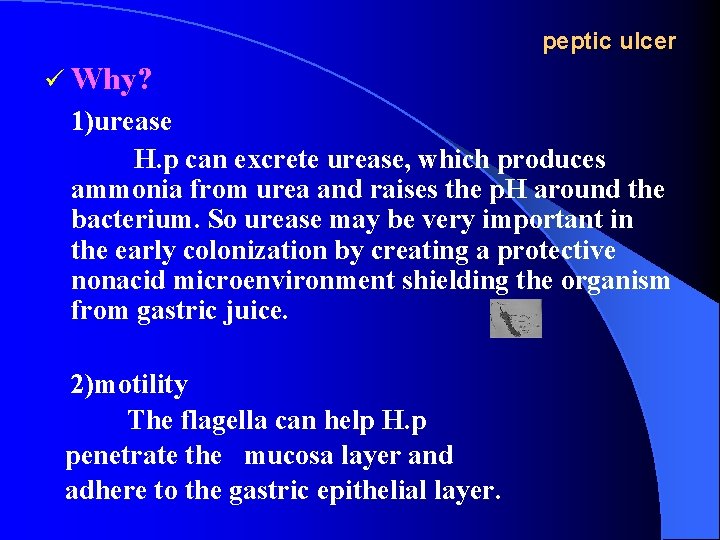 peptic ulcer ü Why? 1)urease H. p can excrete urease, which produces ammonia from
