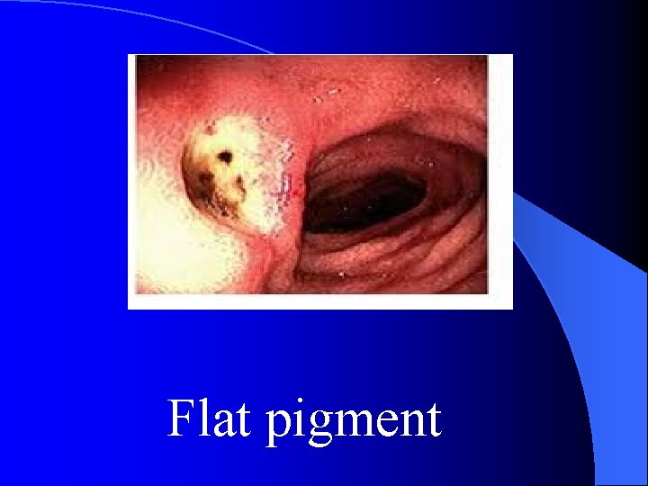 Flat pigment 