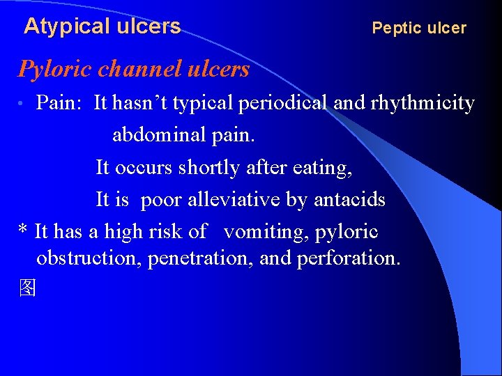 Atypical ulcers Peptic ulcer Pyloric channel ulcers Pain: It hasn’t typical periodical and rhythmicity
