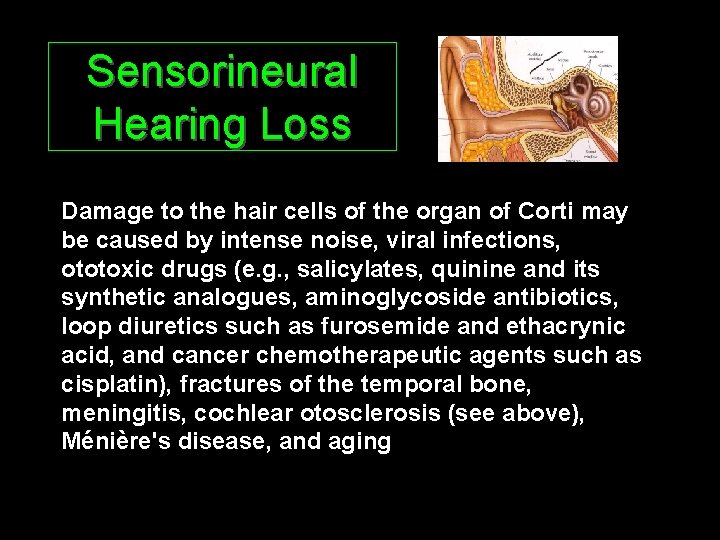 Sensorineural Hearing Loss Damage to the hair cells of the organ of Corti may