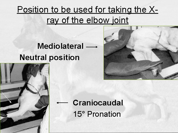 Position to be used for taking the Xray of the elbow joint Mediolateral Neutral
