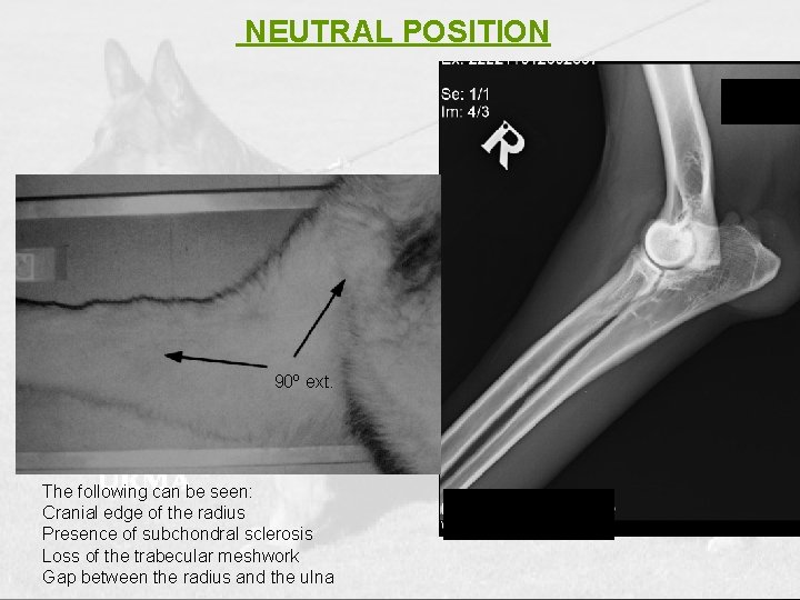 NEUTRAL POSITION 90º ext. The following can be seen: Cranial edge of the radius