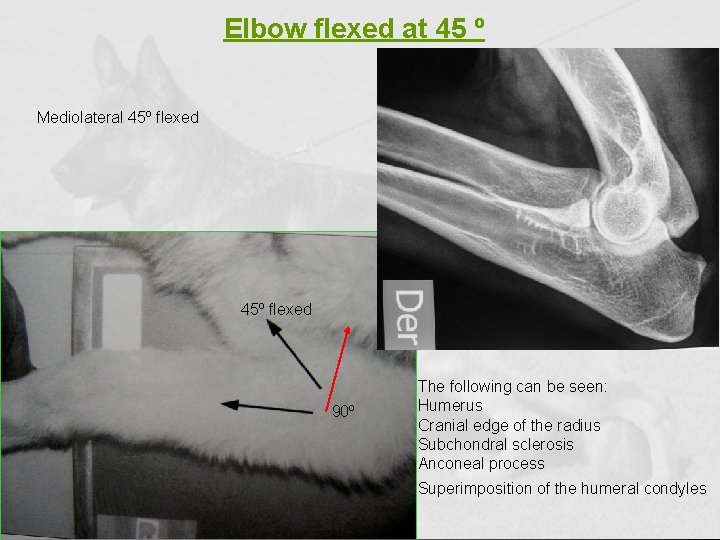 Elbow flexed at 45 º Mediolateral 45º flexed 90º The following can be seen: