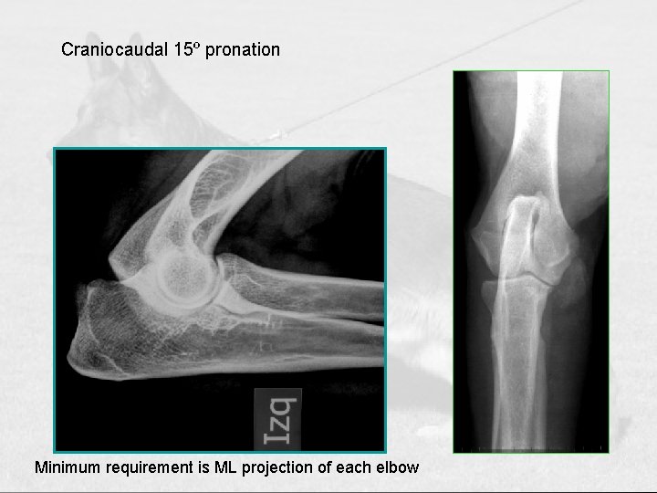 Craniocaudal 15º pronation Minimum requirement is ML projection of each elbow 