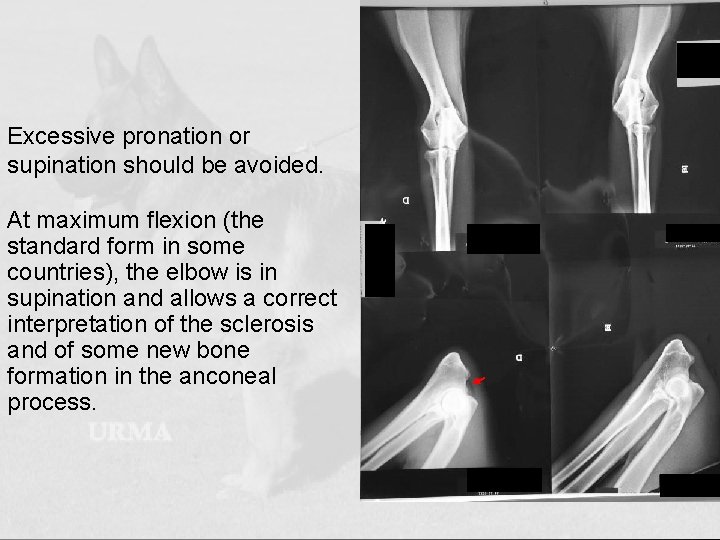Excessive pronation or supination should be avoided. At maximum flexion (the standard form in