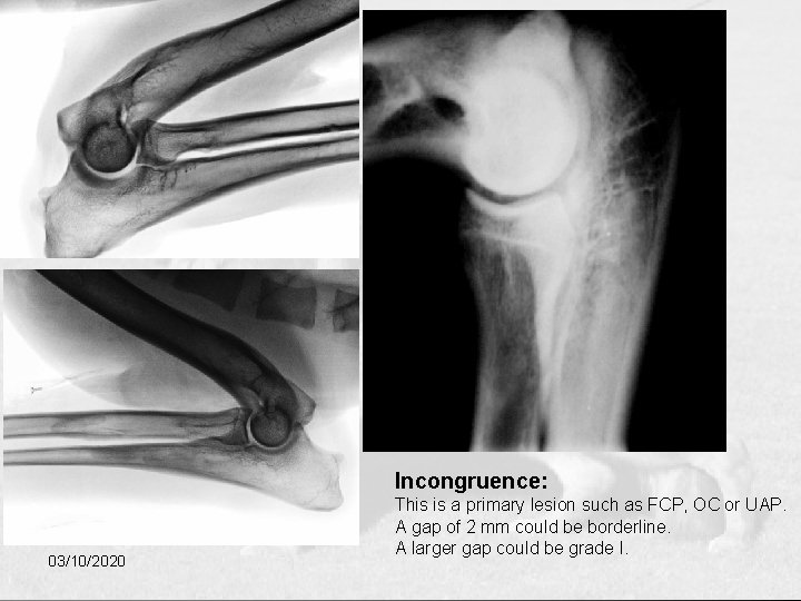 Incongruence: 03/10/2020 This is a primary lesion such as FCP, OC or UAP. A