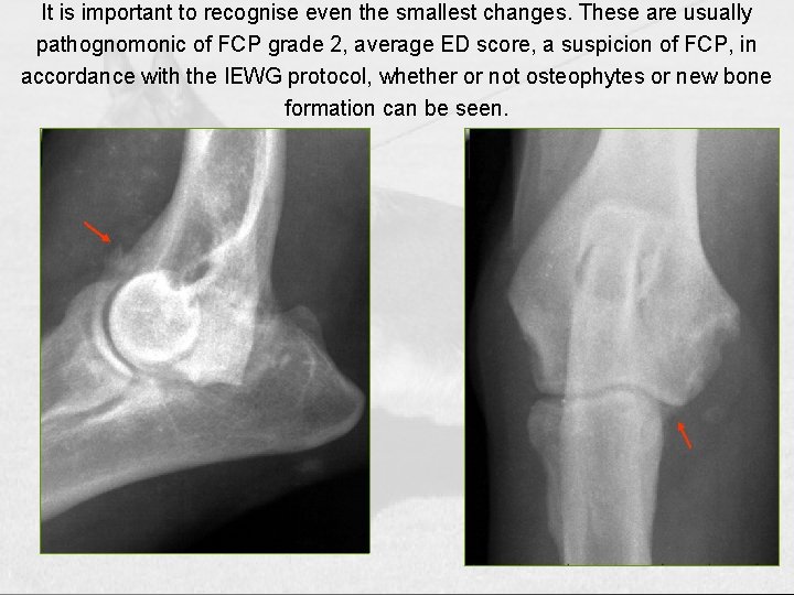 It is important to recognise even the smallest changes. These are usually pathognomonic of