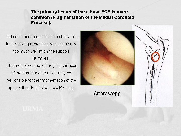 The primary lesion of the elbow, FCP is more common (Fragmentation of the Medial
