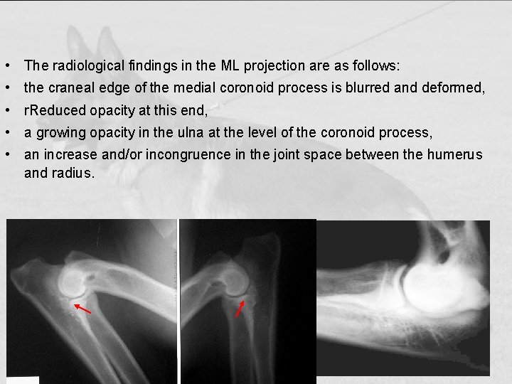  • The radiological findings in the ML projection are as follows: • the