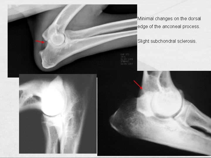 Minimal changes on the dorsal edge of the anconeal process. Slight subchondral sclerosis. 