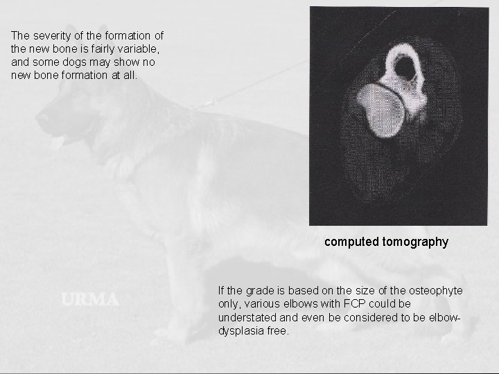 The severity of the formation of the new bone is fairly variable, and some