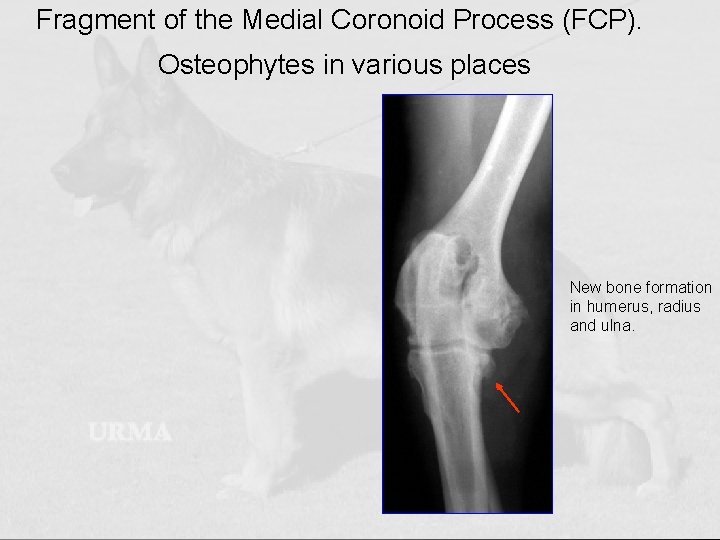 Fragment of the Medial Coronoid Process (FCP). Osteophytes in various places New bone formation