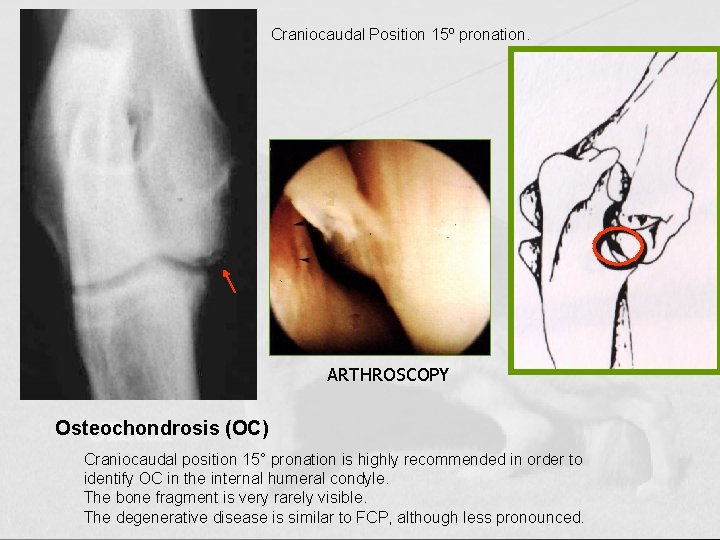 Craniocaudal Position 15º pronation. ARTHROSCOPY Osteochondrosis (OC) Craniocaudal position 15° pronation is highly recommended