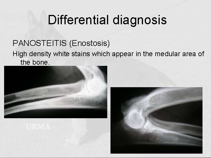Differential diagnosis PANOSTEITIS (Enostosis) High density white stains which appear in the medular area
