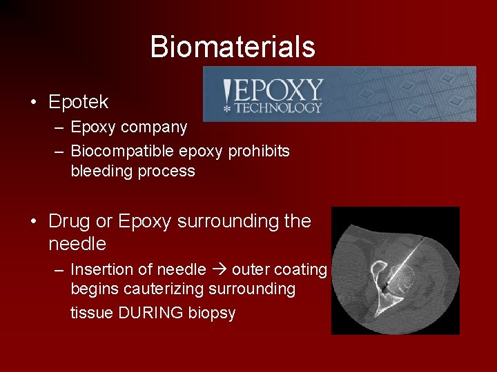 Biomaterials • Epotek – Epoxy company – Biocompatible epoxy prohibits bleeding process • Drug