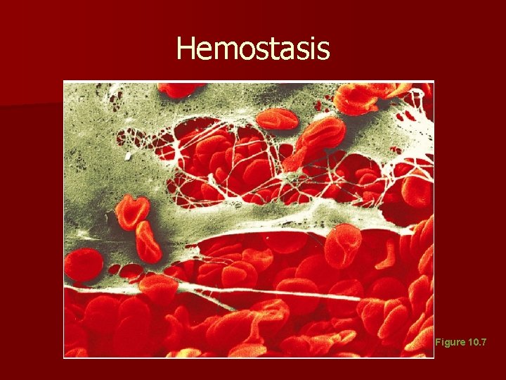 Hemostasis Figure 10. 7 