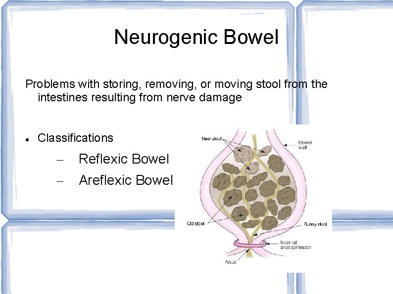 Neurogenic Bowel Problems with storing, removing, or moving stool from the intestines resulting from