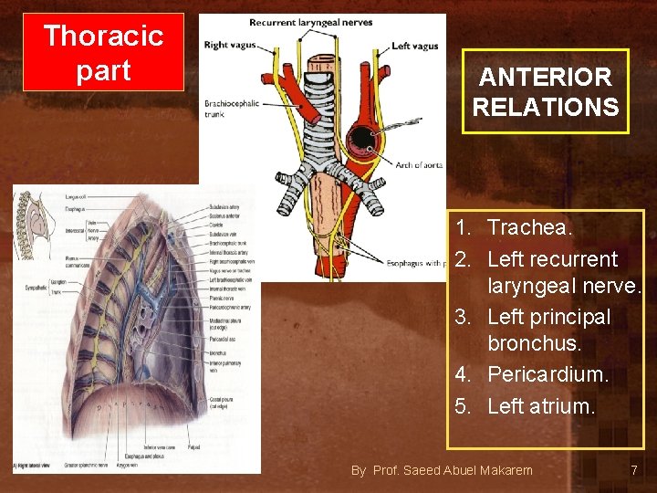 Thoracic part ANTERIOR RELATIONS 1. Trachea. 2. Left recurrent laryngeal nerve. 3. Left principal