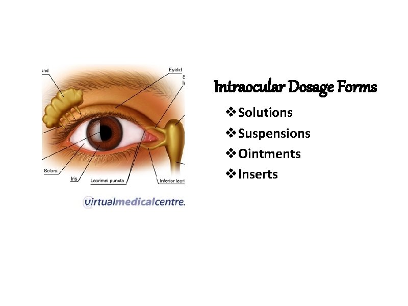 Intraocular Dosage Forms v. Solutions v. Suspensions v. Ointments v. Inserts 