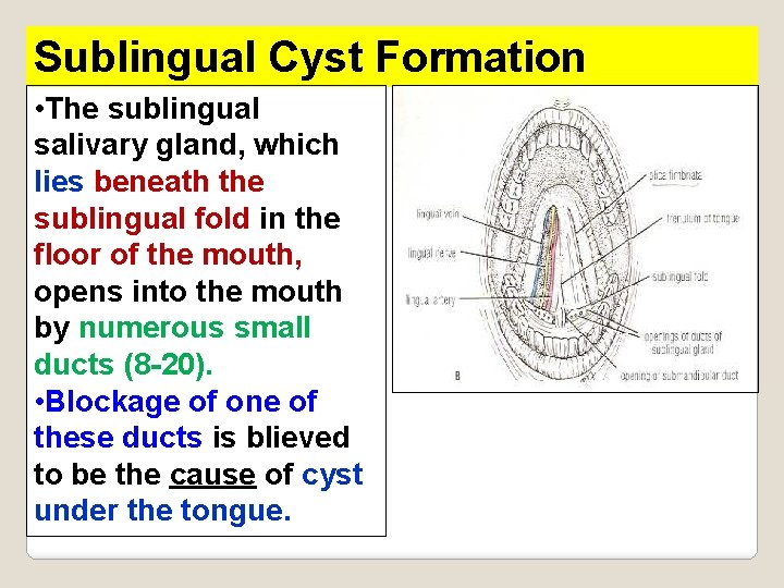 Sublingual Cyst Formation • The sublingual salivary gland, which lies beneath the sublingual fold