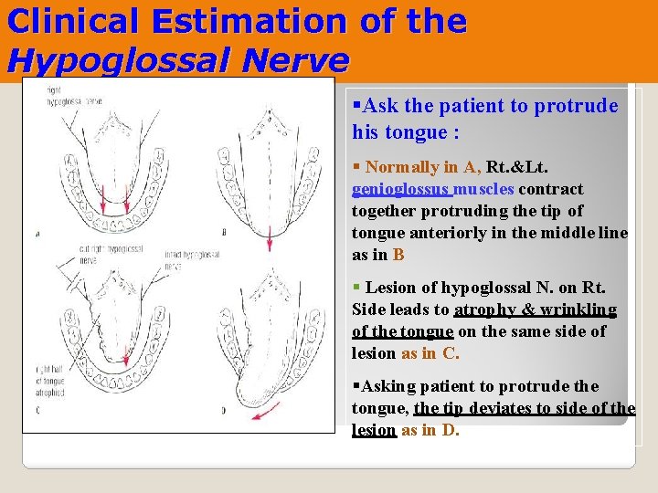 Clinical Estimation of the Hypoglossal Nerve §Ask the patient to protrude his tongue :