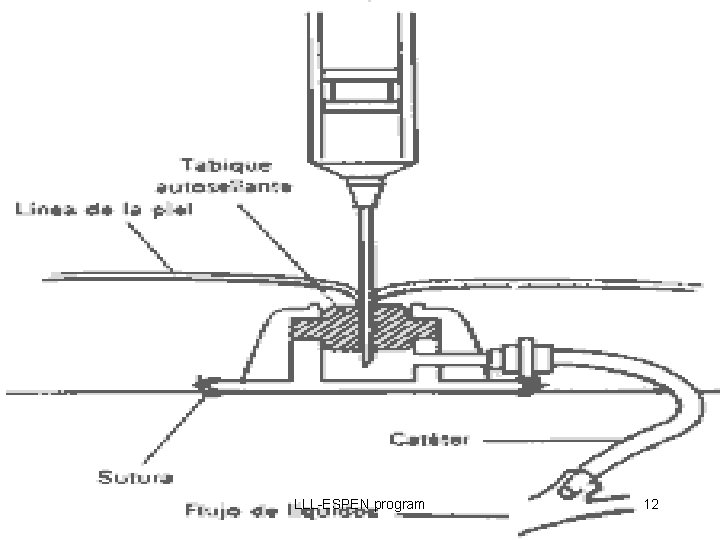 LLL-ESPEN program 12 