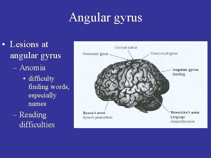 Angular gyrus • Lesions at angular gyrus – Anomia • difficulty finding words, especially