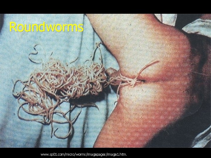 Roundworms www. sp 01. com/micro/worms/imagepages/image 1. htm. 