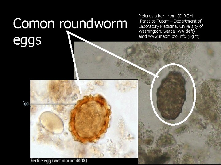 Comon roundworm eggs Pictures taken from CD-ROM „Parasite-Tutor“ – Department of Laboratory Medicine, University