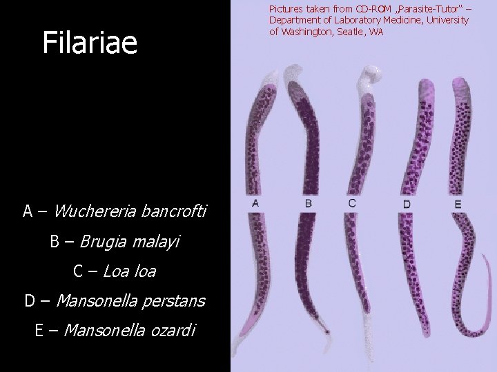 Filariae A – Wuchereria bancrofti B – Brugia malayi C – Loa loa D