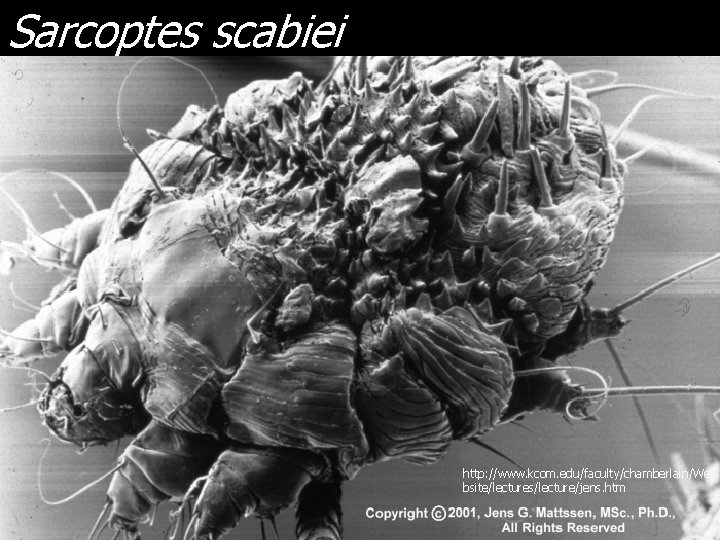 Sarcoptes scabiei http: //www. kcom. edu/faculty/chamberlain/We bsite/lectures/lecture/jens. htm 